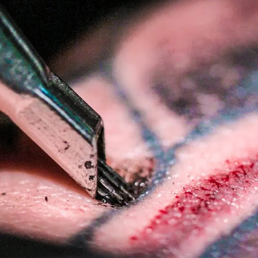 How to Remove Tattoo on Your Body? 5 Recomanded Methods